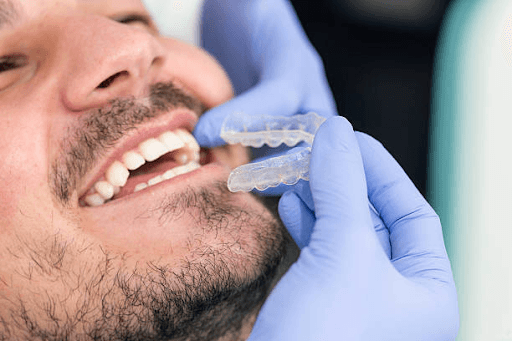 Invisalign as Orthodontic Treatment