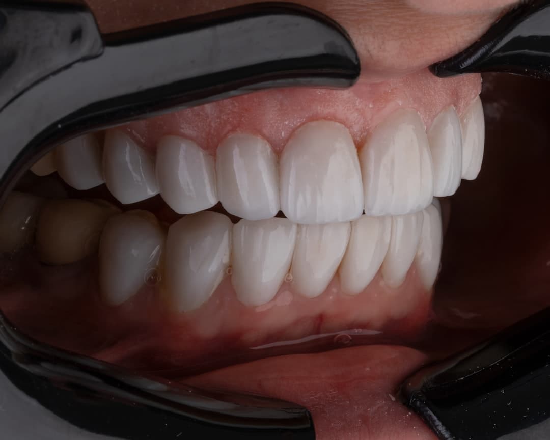 Photo Dentist, X-ray
